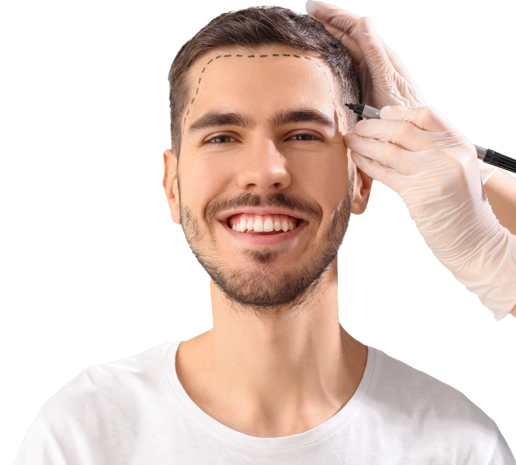 FUE-Hair-Transplant-1